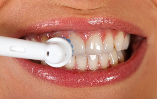 Pestana Dental & Aesthetics | Home 16 scale and polish home | Pestana Dental & Aesthetics